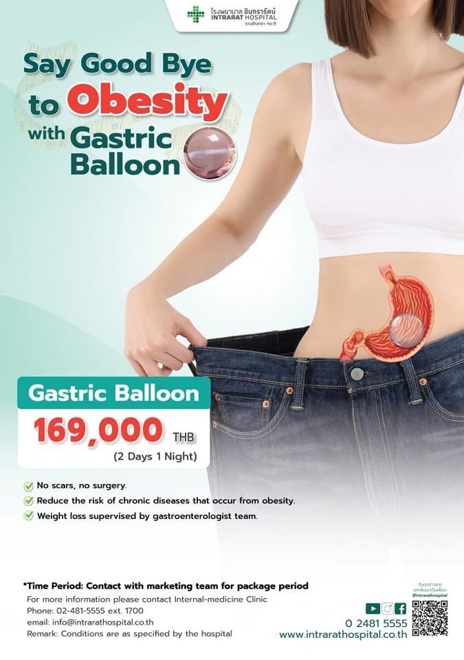 Gastric Balloon — Intrarat Hospital